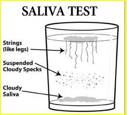 Is Candida Making You Sick? Find Out with This Easy Test & What to Do Next!
